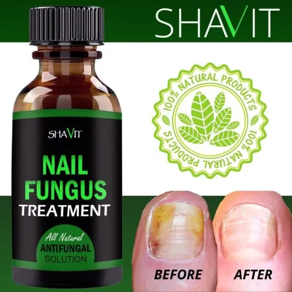 Shavit Natural Toenail Fungus Treatment