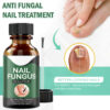 ANTI FUNGAL Toenail Fungus Treatment